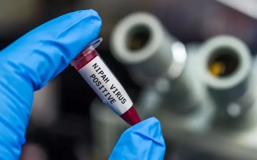 Hindistan'da Nipah vir&uuml;s&uuml; g&ouml;r&uuml;ld&uuml;